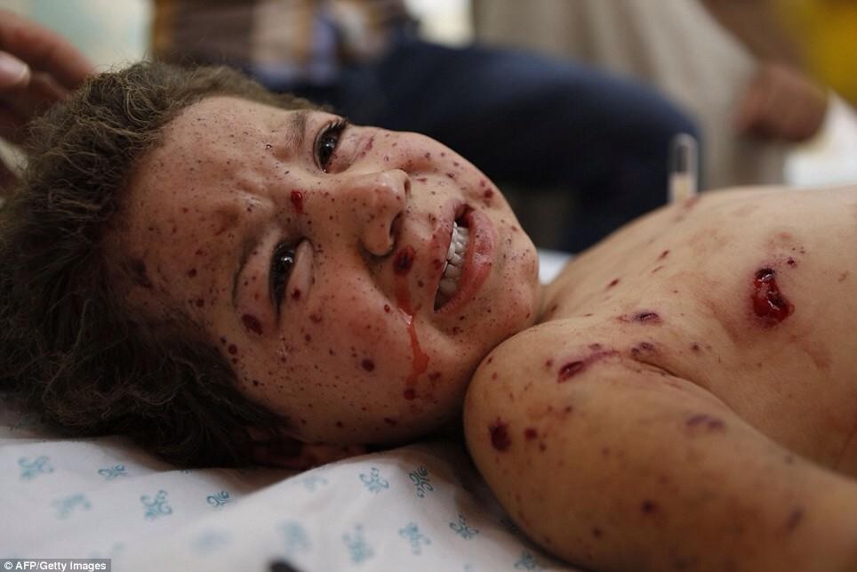 A child being treated after an Israeli attack on Gaza. Credit: AFP/Getty