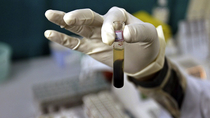 Roughly 15 million Egyptians suffer from the deadly Hepatitis C virus
