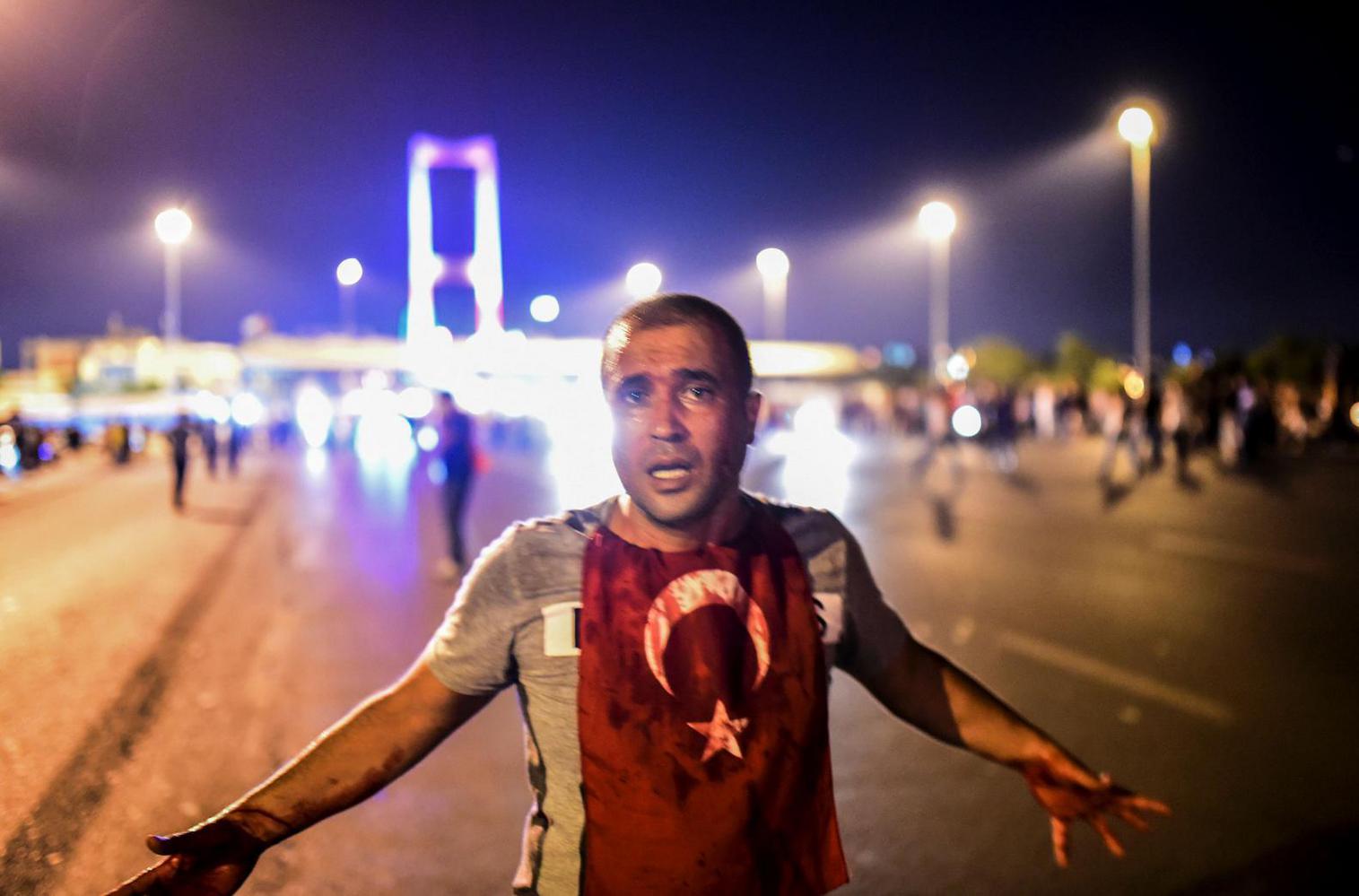 A man covered with blood stands near Bosphorus bridge during the coup attempt in Istanbul. (Credit: AFP/Bulent Kilic)