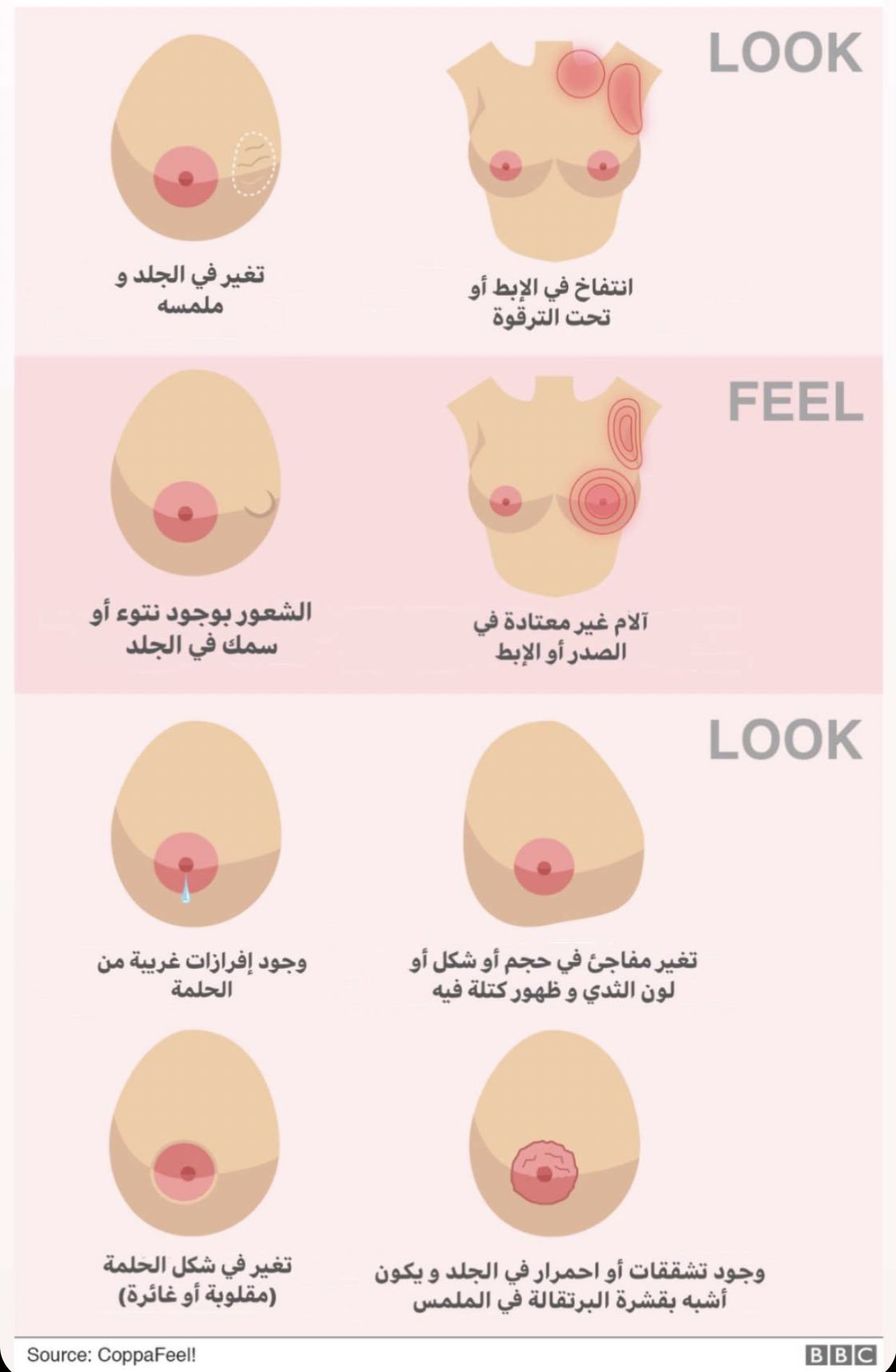 What Are the Symptoms and Signs of Breast Cancer?